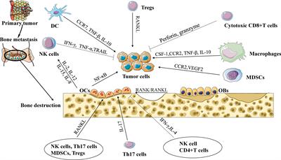 Contribution of immune cells to bone metastasis pathogenesis